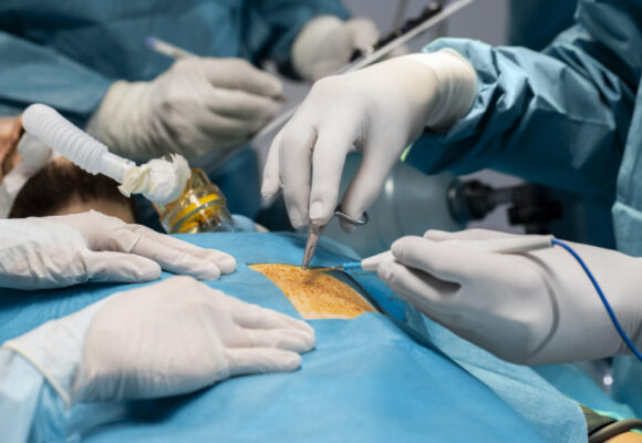 Minimally Invasive Cardiac Surgery